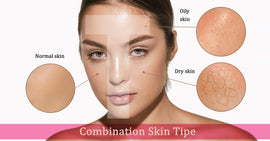 What Is Combination Skin? A Comprehensive Guide